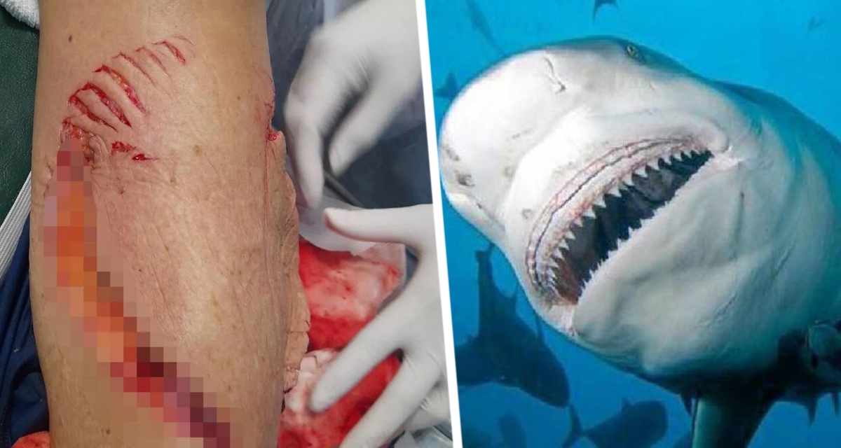 Мальдивская идиллия омрачена: Акула атаковала российскую туристку Мальдивская идиллия омрачена: Акула атаковала российскую туристку